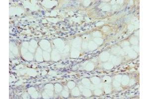 Immunohistochemistry of paraffin-embedded human colon tissue using ABIN7148825 at dilution of 1:100