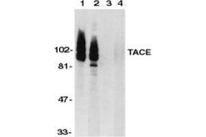 Western blot analysis of TACE in HeLa (1,3) and Jurkat (2,4) whole cell lysate in the absence (1,2) or presence (3,4) of blocking peptide with TACE Antibody  at 1 μg/ml. (ADAM17 Antikörper  (C-Term))