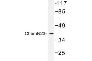 Image no. 1 for anti-Chemokine-Like Receptor 1 (CMKLR1) antibody (ABIN272278) (CMKLR1 Antikörper)