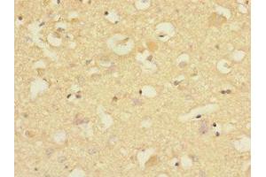 Immunohistochemistry of paraffin-embedded human brain tissue using ABIN7148481 at dilution of 1:100 (CNTNAP1 Antikörper  (AA 20-300))