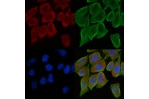 ABIN6259045 and ABIN6275255 staining Hela cells(30 min of UV treatment) by IF/ICC. (MEGF8 Antikörper  (Internal Region))