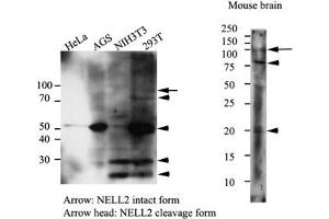 Western Blotting (WB) image for anti-NEL-Like 2 (Chicken) (NELL2) antibody (ABIN614304) (NELL2 Antikörper)