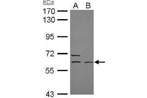 WB Image ELP3 antibody [N3C3] detects ELP3 protein by Western blot analysis. (ELP3/KAT9 Antikörper  (Center))