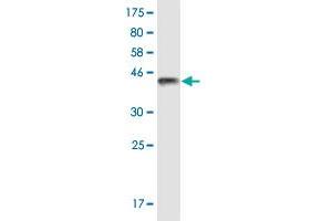 Western Blot detection against Immunogen (37. (TRPV1 Antikörper  (AA 21-124))