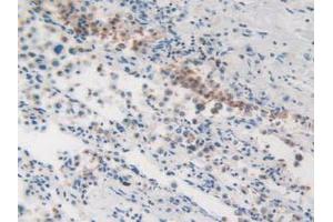 IHC-P analysis of Human Lung Tissue, with DAB staining. (MVP Antikörper  (AA 2-272))
