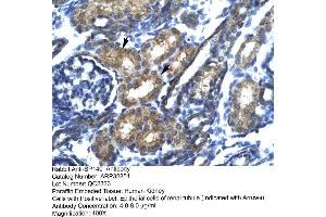 Immunohistochemistry (IHC) image for anti-SP140 Nuclear Body Protein (SP140) (N-Term) antibody (ABIN2777631) (SP140 Antikörper  (N-Term))