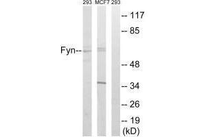Western blot analysis of extracts from HUVEC cells, MCF-7 cells and 293 cells, using Fyn (Ab-530) antibody. (FYN Antikörper  (Tyr530))