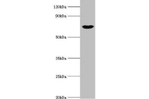 Western blot All lanes: cGMP-dependent protein kinase 1 antibody at 3 μg/mL + Mouse lung tissue Secondary Goat polyclonal to rabbit IgG at 1/10000 dilution Predicted band size: 77, 78, 45 kDa Observed band size: 77 kDa (PRKG1 Antikörper  (AA 1-300))