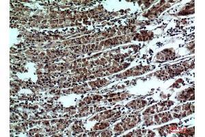 Immunohistochemistry (IHC) analysis of paraffin-embedded Human Stomach, antibody was diluted at 1:100. (PPP1R15B Antikörper  (Internal Region))