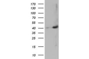 HEK293T cells were transfected with the pCMV6-ENTRY control (Left lane) or pCMV6-ENTRY MAGEB18 (Right lane) cDNA for 48 hrs and lysed. (MAGEB18 Antikörper)