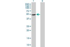 Western Blot analysis of GART expression in transfected 293T cell line by GART MaxPab polyclonal antibody. (GART Antikörper  (AA 1-433))