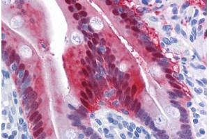 Immunohistochemistry (Formalin-fixed Paraffin-embedded Sections) (IHC (fp)) image for anti-Aldo-Keto Reductase Family 1, Member B10 (Aldose Reductase) (AKR1B10) (AA 76-144) antibody (ABIN574456)