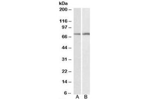Western blot testing of HepG2 [A] and K562 [B] lysates with CYP2B6 antibody at 0. (CYP2B6 Antikörper)