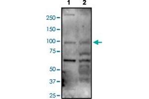 Western blot analysis of Lane 1: A549 and Lane 2: MCF-7 cell lysates with ARHGAP12 polyclonal antibody . (ARHGAP12 Antikörper)