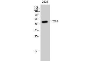 Western Blotting (WB) image for anti-Paired Box 1 (PAX1) (Internal Region) antibody (ABIN3186338)