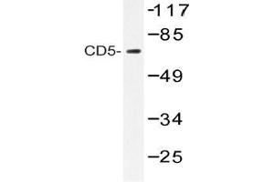 Figure 1. (CD5 Antikörper)