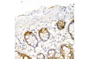 Immunohistochemistry of paraffin-embedded human small intestine using DDC Rabbit pAb (ABIN1679510, ABIN3018150, ABIN3018151 and ABIN6220384) at dilution of 1:25 (40x lens). (DDC Antikörper  (AA 1-100))