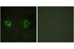 Immunofluorescence (IF) image for anti-Collagen, Type IV, alpha 3 (COL4A3) (AA 801-850) antibody (ABIN2889912) (COL4a3 Antikörper  (AA 801-850))
