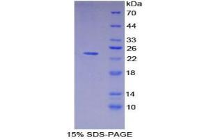 SDS-PAGE analysis of Pig MHCDRa Protein.