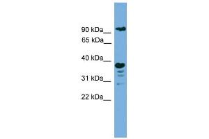 WB Suggested Anti-LAMP1 Antibody Titration: 0. (LAMP1 Antikörper  (N-Term))