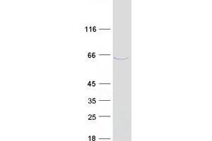 Validation with Western Blot (CCDC7 Protein (Transcript Variant 2) (Myc-DYKDDDDK Tag))