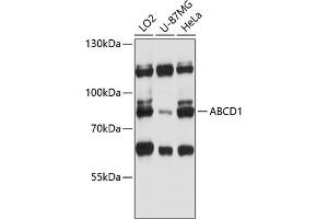 Western blot analysis of extracts of various cell lines, using  antibody (ABIN6129183, ABIN6136369, ABIN6136370 and ABIN6215725) at 1:3000 dilution. (ABCD1 Antikörper  (AA 340-500))