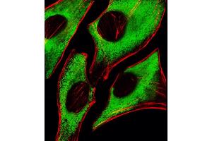Immunofluorescence (IF) image for anti-Ribosomal Protein S6 (RPS6) antibody (ABIN6242615)
