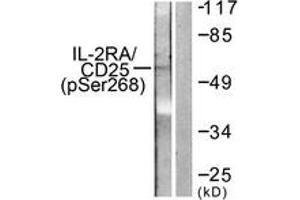 Western blot analysis of extracts from LOVO cells, using IL-2R alpha/CD25 (Phospho-Ser268) Antibody. (CD25 Antikörper  (pSer268))