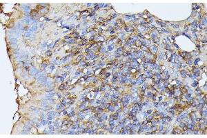 Immunohistochemistry of paraffin-embedded Rat lung using STK24 Polyclonal Antibody at dilution of 1:100 (40x lens). (STK24 Antikörper)
