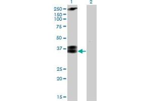 Western Blot analysis of CACNG3 expression in transfected 293T cell line by CACNG3 monoclonal antibody (M01), clone 3E4. (CACNG3 Antikörper  (AA 199-297))