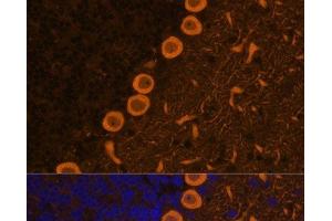Immunofluorescence analysis of Rat brain cells using PRKCG Polyclonal Antibody at dilution of 1:100. (PKC gamma Antikörper)