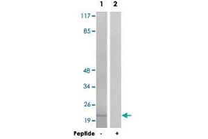 Western blot analysis of extracts from HT-29 cells, using PPP1R14A polyclonal antibody . (CPI-17 Antikörper)