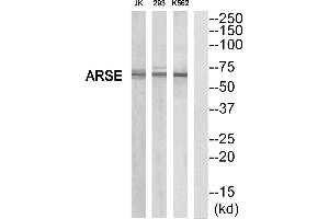 Western blot analysis of extracts from K562/293/Jurkat cells, using ARSE antibody. (Arylsulfatase E Antikörper  (Internal Region))