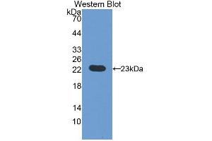 Western Blotting (WB) image for anti-Von Hippel-Lindau Tumor Suppressor, E3 Ubiquitin Protein Ligase (VHL) (AA 6-175) antibody (ABIN7441592)