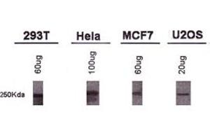 Western blot analysis of BRCA1 using BRCA1 monoclonal antibody, clone KEN . (BRCA1 Antikörper  (AA 1314-1864))