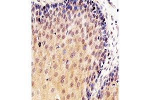 Immunohistochemistry (Paraffin-embedded Sections) (IHC (p)) image for anti-Tumor Protein P53 (TP53) (AA 364-393) antibody (ABIN1882106)