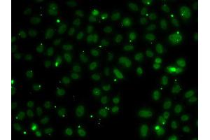 Immunofluorescence analysis of A549 cell using NSL1 antibody. (NSL1 Antikörper)