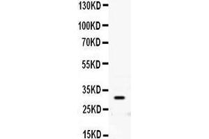 Observed bind size: 30KD (PRNP Antikörper  (AA 143-230))