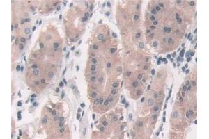 Immunohistochemistry (IHC) image for anti-Fucosyltransferase 6 (Alpha (1,3) Fucosyltransferase) (FUT6) (AA 35-359) antibody (ABIN7435952)