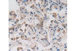 Used in DAB staining on fromalin fixed paraffin- embedded lung tissue (CDKN2D Antikörper  (AA 1-166))