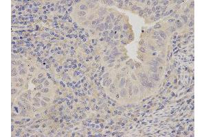 Immunohistochemistry (IHC) image for anti-Lipopolysaccharide-Induced Tumor Necrosis Factor-alpha Factor (LITAF) antibody (ABIN1876657) (LITAF Antikörper)
