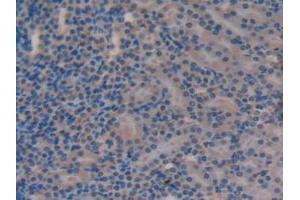 IHC-P analysis of Mouse Kidney Tissue, with DAB staining. (Versican Antikörper  (AA 3058-3299))