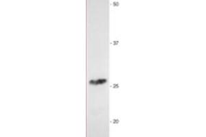 Western Blotting (WB) image for anti-Myelin Protein Zero (MPZ) antibody (ABIN953494) (MPZ Antikörper)