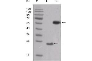 Western Blot showing SRC antibody used against truncated SRC-His recombinant protein (1) and PMA treated THP-1 cell lysate (2). (Src Antikörper  (AA 10-193))