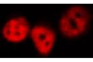 Immunofluorescence (fixed cells) (IF/ICC) image for anti-Nuclear Factor of kappa Light Polypeptide Gene Enhancer in B-Cells 1 (NFKB1) (pSer893) antibody (ABIN6255551)