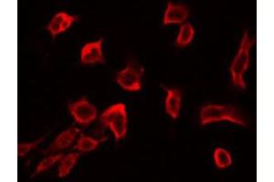 ABIN6272421 staining RAW264. (RSU1 Antikörper  (C-Term))