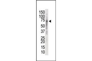 Image no. 1 for anti-Interleukin-1 Receptor-Associated Kinase 2 (IRAK2) (C-Term) antibody (ABIN360118) (IRAK2 Antikörper  (C-Term))