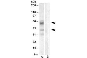 Western blot testing of A459 lysate with Arylsulfatase D antibody with [B] and without [A] blocking/immunizing peptide. (Arylsulfatase D Antikörper)