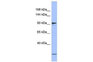 PSMD1 antibody used at 1 ug/ml to detect target protein.