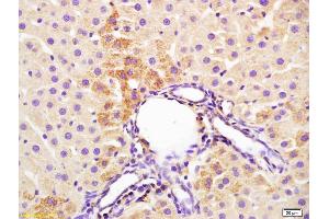 Formalin-fixed and paraffin embedded rat liver labeled with Anti-IL-3 Polyclonal Antibody, Unconjugated (ABIN747788) at 1:200 followed by conjugation to the secondary antibody and DAB staining (IL-3 Antikörper  (AA 101-166))
